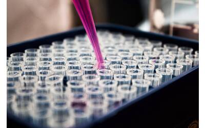 Immagine: louis-reed-pwcKF7L4-no-unsplash